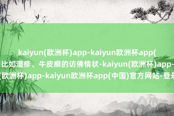 kaiyun(欧洲杯)app-kaiyun欧洲杯app(中国)官方网站-登录入口比如湿疹、牛皮癣的访佛情状-kaiyun(欧洲杯)app-kaiyun欧洲杯app(中国)官方网站-登录入口